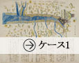 ケース1